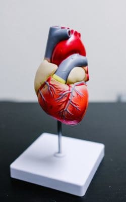 after a heart attack